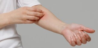 skora wysypka swedzi,jpg