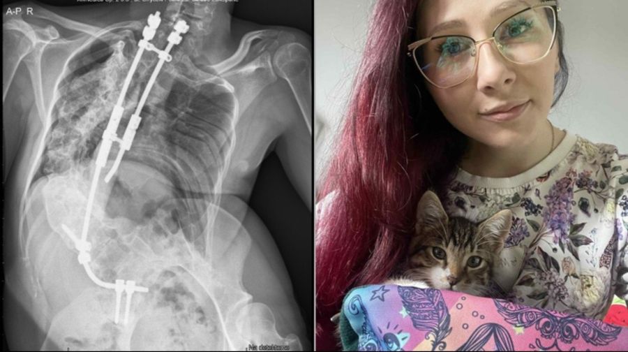 Akcja charytatywna „Świąteczny cud dla Zuzanny” w Powiatowym Centrum Sportu w Raciborzu 21 grudnia